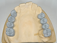 「まさき歯科」の入れ歯治療